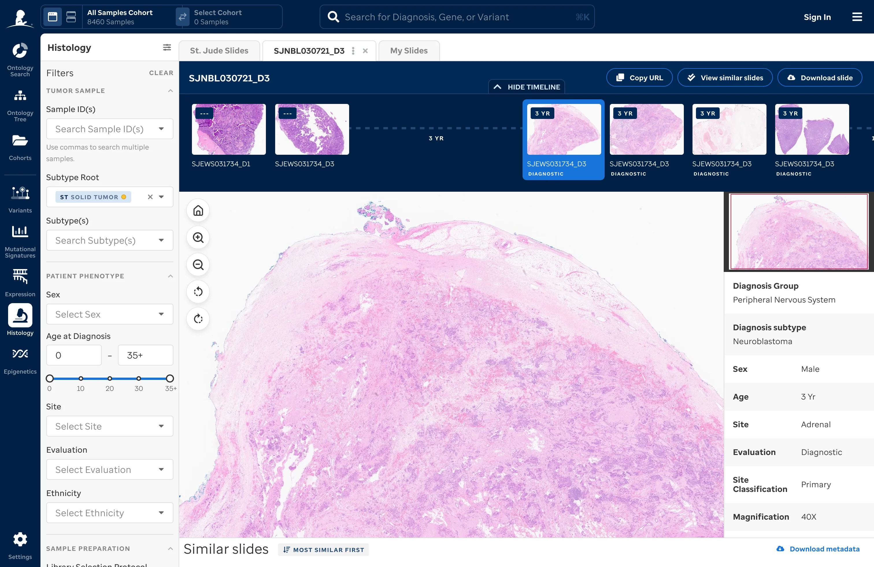 Cohort histology detail